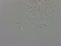 Echiniscus trisetosus image