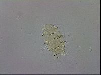 Echiniscus trisetosus image