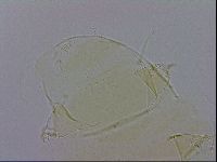 Echiniscus trisetosus image