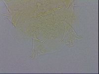 Echiniscus trisetosus image