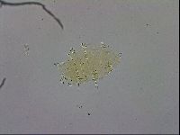 Echiniscus trisetosus image