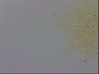 Echiniscus trisetosus image