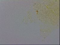 Echiniscus trisetosus image