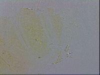 Echiniscus trisetosus image