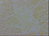 Echiniscus trisetosus image