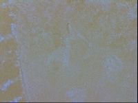 Echiniscus trisetosus image