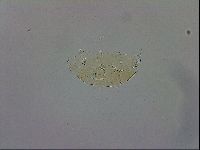 Echiniscus trisetosus image