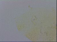 Echiniscus trisetosus image