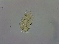 Echiniscus trisetosus image