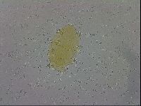 Echiniscus trisetosus image