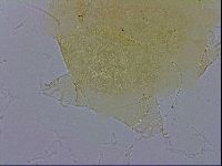 Echiniscus trisetosus image
