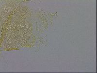 Echiniscus trisetosus image