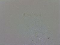 Echiniscus trisetosus image