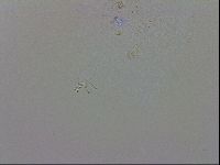 Echiniscus trisetosus image