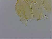 Echiniscus trisetosus image