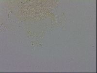 Echiniscus trisetosus image