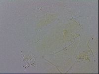 Echiniscus trisetosus image