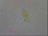 Echiniscus trisetosus image