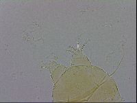 Echiniscus trisetosus image