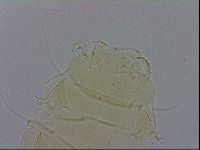 Echiniscus trisetosus image