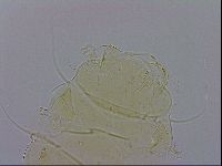 Echiniscus trisetosus image