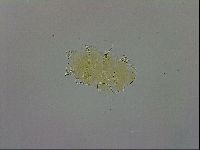 Echiniscus trisetosus image