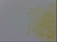 Echiniscus trisetosus image