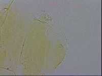 Echiniscus trisetosus image