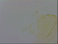 Echiniscus trisetosus image