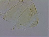 Echiniscus trisetosus image
