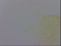 Echiniscus trisetosus image
