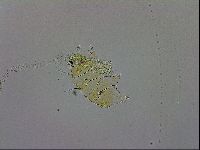 Echiniscus trisetosus image