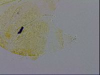 Echiniscus trisetosus image