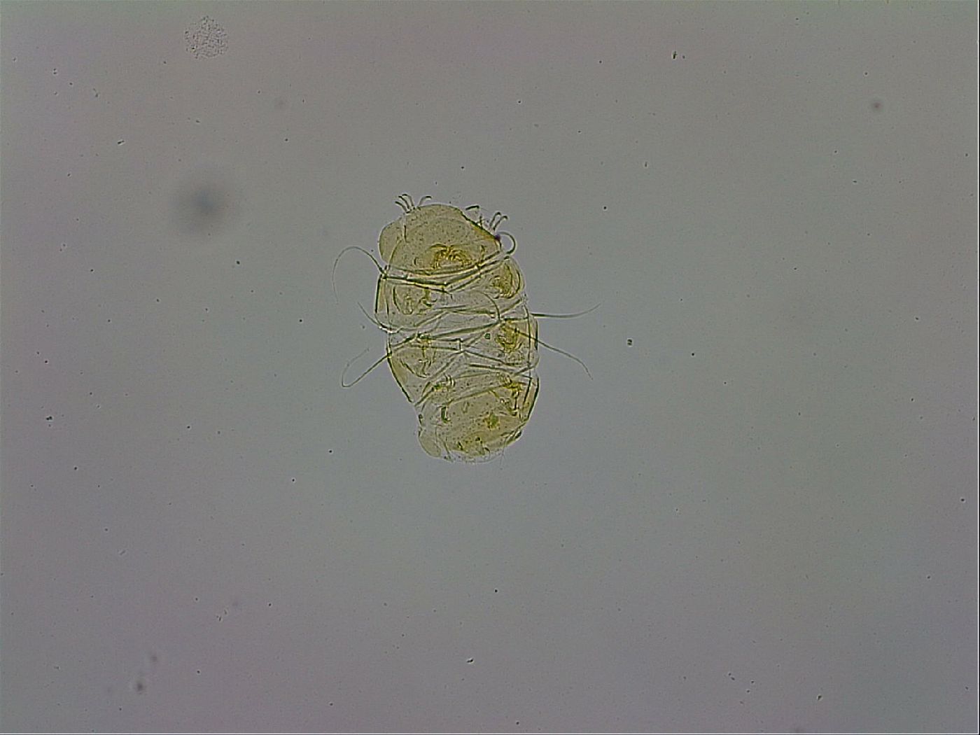 Echiniscus trisetosus image
