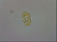 Echiniscus trisetosus image