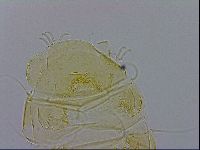 Echiniscus trisetosus image