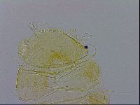 Echiniscus trisetosus image