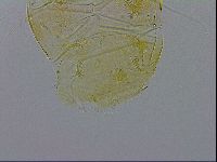 Echiniscus trisetosus image