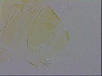 Echiniscus trisetosus image