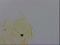 Echiniscus trisetosus image