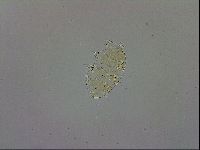 Echiniscus trisetosus image