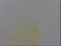 Echiniscus trisetosus image