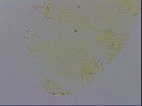 Echiniscus trisetosus image