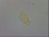 Echiniscus trisetosus image