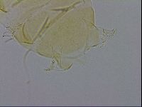 Echiniscus trisetosus image