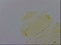 Echiniscus trisetosus image
