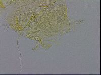 Echiniscus trisetosus image