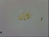 Echiniscus trisetosus image