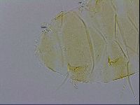 Echiniscus trisetosus image
