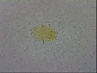 Echiniscus trisetosus image